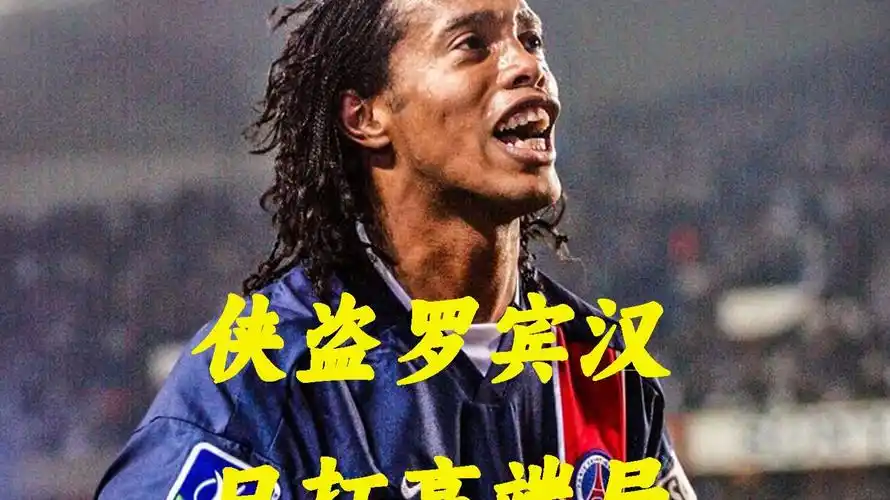 阿瑙托维奇